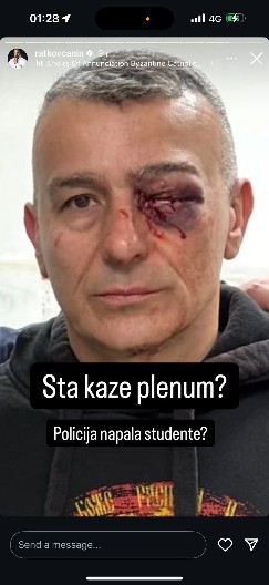 "STUDENTSKO ZLO" Babić: Šta kažu plenumi, policija napala studente? (FOTO)