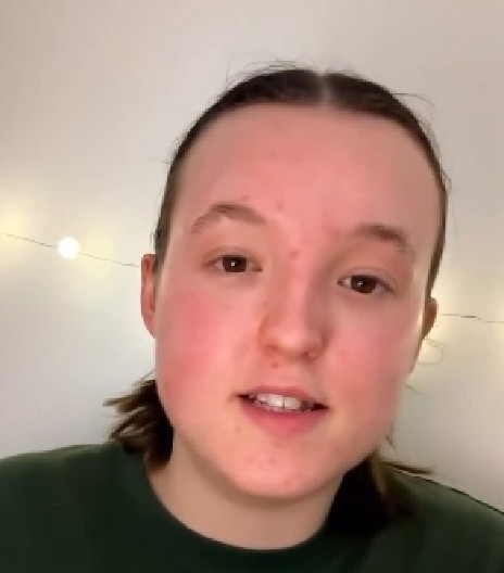 GLUMICA DOBILA ŠOK DIJAGNOZU U 21. GODINI: "Osećala sam se kao da sam u nekoj kutiji"