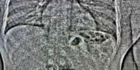 LOPOV PROGUTAO PLEN VREDAN 740.000 EVRA! Bio u njemu više od 10 dana! (FOTO)