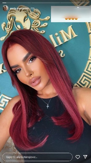 ANITA STANOJLOVIĆ BEZ BRUSA! Snimala se u šok izdanju, podigla majicu, a svi jedno komentarišu (FOTO)