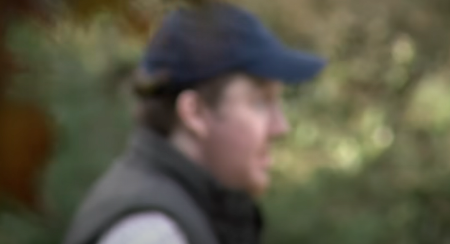 ŽIVEO JE BEZ LICA 11 GODINA U mladosti je doneo odluku koja ga je skupo koštala, ali sada je dobio novu šansu i izgleda ovako