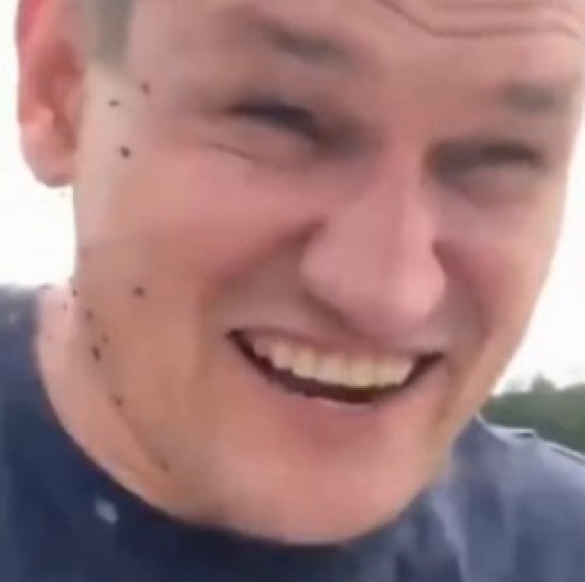 KRVOLOČNI INSEKTI GA OPKOLILI, PREKRILI MU CELO TELO Muškarac postao živa meta, snimak ledi krv u žilama! (VIDEO)