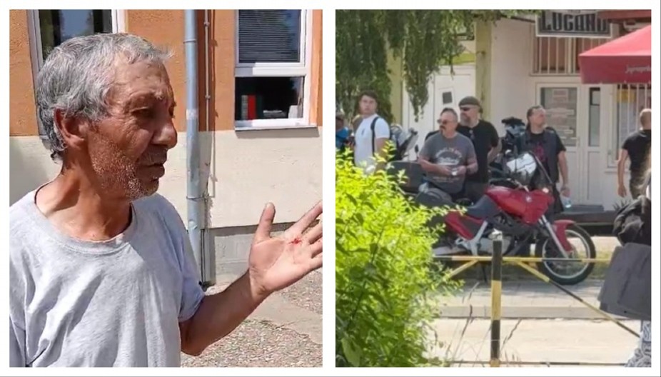 BATINAŠI TUKLI GLASAČA NA IZBORNOM MESTU U ZAJEČARU Čovek je krvav, ovo su lica nasilnika!