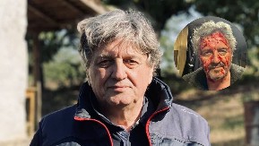 LICE RADOŠA BAJIĆA PREKRIVENO KRVLJU! Potresne scene, glumcu stiže podrška: "Drži se..."