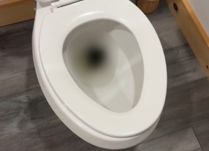 NOĆNA MORA U SOPSTVENOJ KUĆI! Pogledala u WC šolju i ZANEMELA - zbog jezivog stvorenja završila u bolnici (VIDEO)