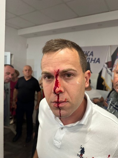 BLOKADERI MU RAZBILI GLAVU Teško povređen čovek u Lazarevcu! Nasilnici krenuli protiv građana (FOTO)