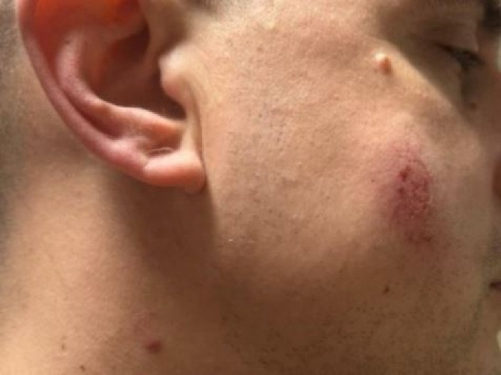 RASTE BROJ POVREĐENIH POLICAJCA U PANČEVU! Blokaderi teroristi jednog pogodili kamenom u glavu! (FOTO)