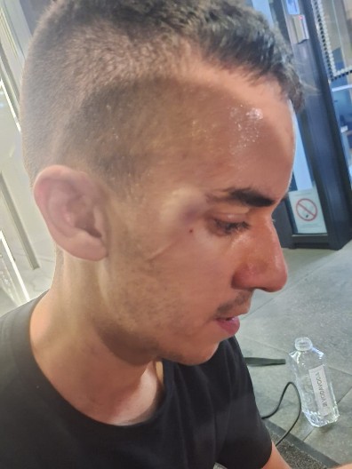 FAŠISTI! Ustaški blokaderi izubijali mladića snimatelja Informera! (FOTO)