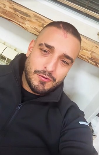 DARKO LAZIĆ OBJAVIO SNIMAK KAO DOKAZ Pevač nakon vesti da je polomio rebro iznenadio potezom: "Hoću da ljudi koji čitaju vest, znaju da..."