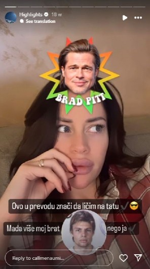 ''NAPRAVILA MI JE POVREDU'' Mina Naumović se oglasila o nezgodi oka koju je imala kod kuće