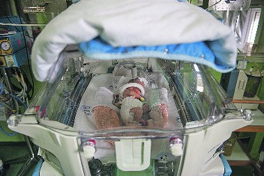 ZA NAŠU DECU! Mobilni rendgen za prevremeno rođene bebe!