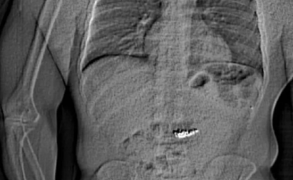 LOPOV UKRAO MINĐUŠE, PA IH PROGUTAO PRE HAPŠENJA! Razotkrio ga rendgenski snimak!