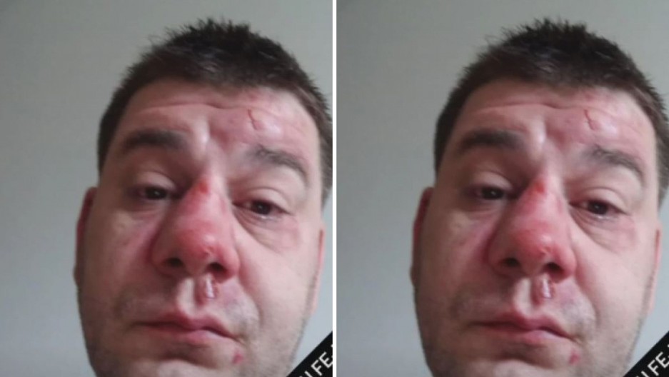 IVAN MARINKOVIĆ U JEZIVIM RANAMA! Zadobio teške povrede, lice mu potpuno izgrebano! (FOTO)