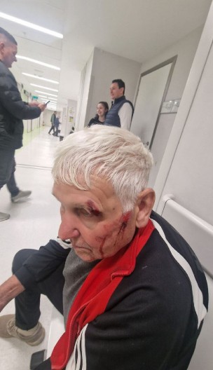 DOKAZANI LAŽOV Dok Šarović glumi žrtvu, deka zbog "kore od banane" završio krvav u hodniku Urgentnog!