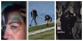 DA LI ĆE ONI ODGOVARATI? Gađali žene kamenjem i jajima u glavu, teško povređeno šest osoba! (FOTO/VIDEO)