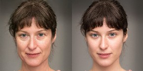 JEFTINO, A ZAČAS LICU VRAĆA SVEŽINU Otkriven tajni recept za brzo zatezanje bora i brisanje podočnjaka