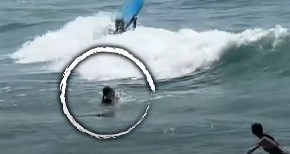 DRAMA NA MORU Jezivo stvorenje ugrizlo devojčicu za nogu i povuklo u dubine – borba za život koja je šokirala sve! (VIDEO)