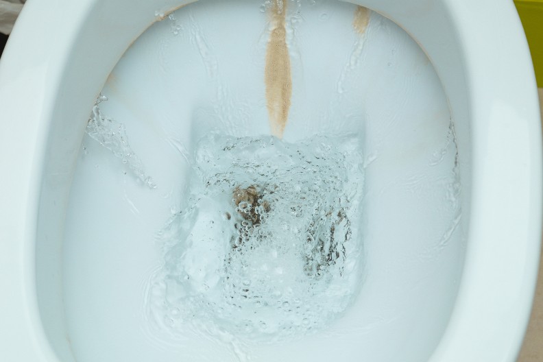 I ONO CRNILO, I ŽUTILO, MA SVE SKIDA KAO OD ŠALE Nije soda bikarbona, ni sirće, a čisti wc šolju bolje od oba