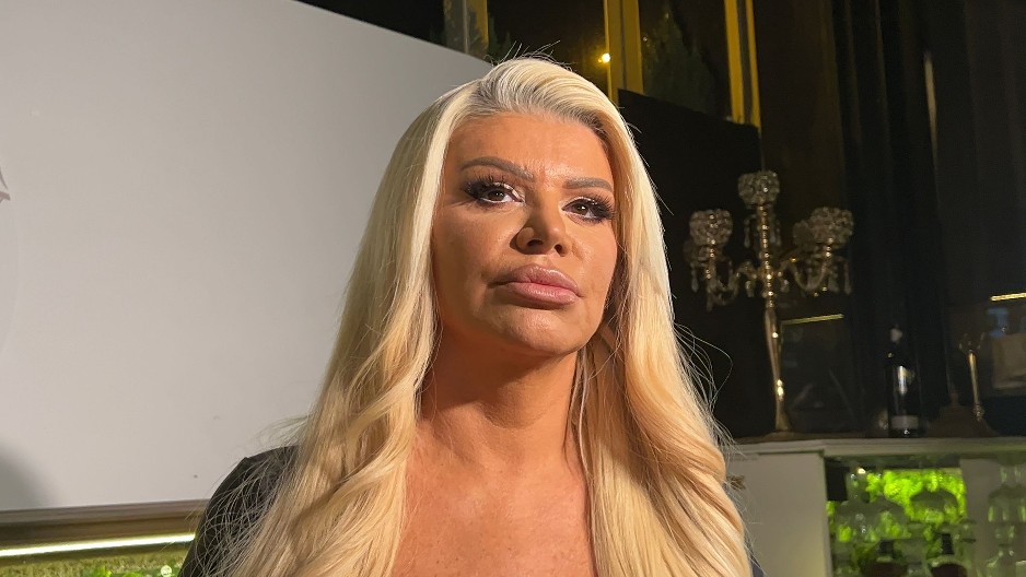 "NJEGA KAD VIDIM OSPICE DOBIJEM" Dara Bubamara progovorila o pevaču koga ne može da gleda očima!