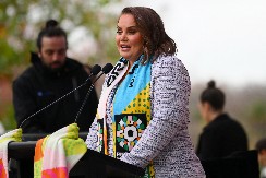 OVO JE OD SAMO JEDNOG PREBIJANJA Jelena Dokić pokazala jezive ožiljke (FOTO)