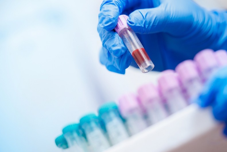 MEDICINSKA SESTRA UBILA 10 PACIJENATA! Ubrizgavala im SMRTONOSNE injekcije da sebi rastereti smenu!