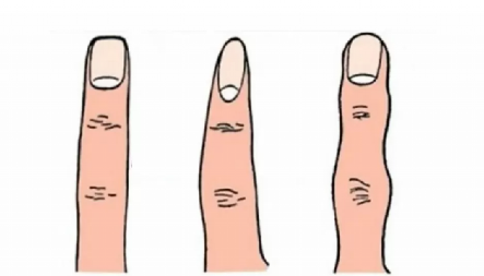 POGLEDAJTE SVOJE PRSTE Njihov oblik određuje vaše najskrivenije osobine - iznenadićete se