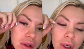 CRVENO I OTEČENO OKO! Naša rijaliti učesnica objavila uznemirujući snimak: "Mnogo me boli" (FOTO)