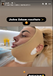 U ZAVOJIMA OKO GLAVE NAKON REMONTA! Bivša zadrugarka se oglasila iz bolničkog kreveta (FOTO)