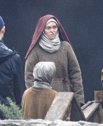 OŽILJAK NA USNI, ORONULO LICE, TUŽNE OČI Sam pogled na čuvenu glumicu budi jezu