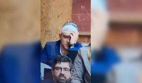 KAKVO PRENEMAGANJE POSLANIKA ZLF! Došao na sednicu sa čalmom na glavi, pa glumio žrtvu (VIDEO)